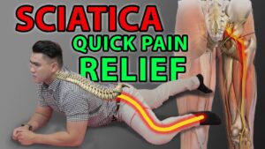 sciatica pain relief